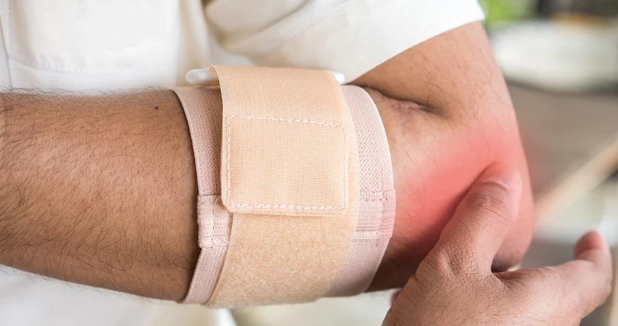 Lateral Epicondylitis