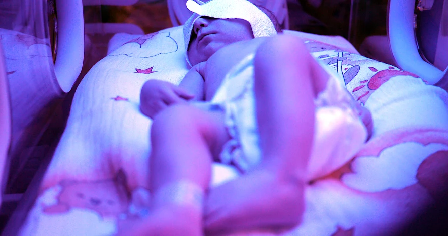 Newborn Brachial Plexus Injuries