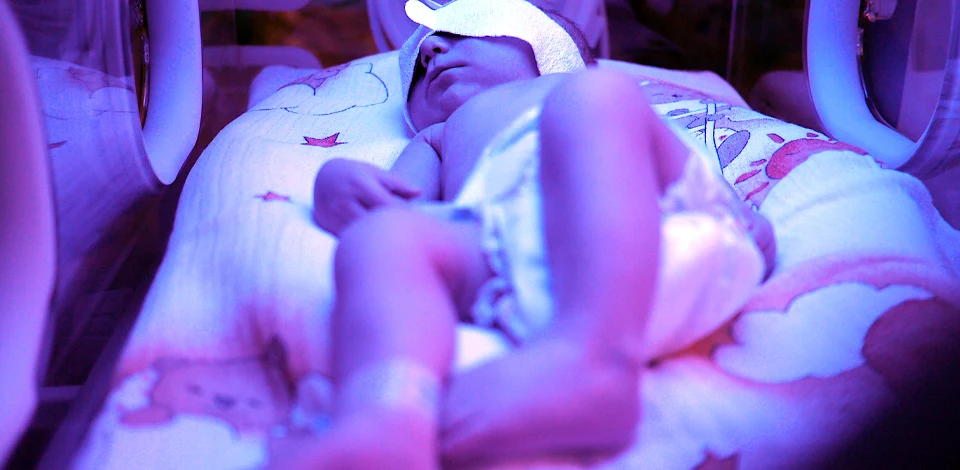 Newborn Brachial Plexus Injuries