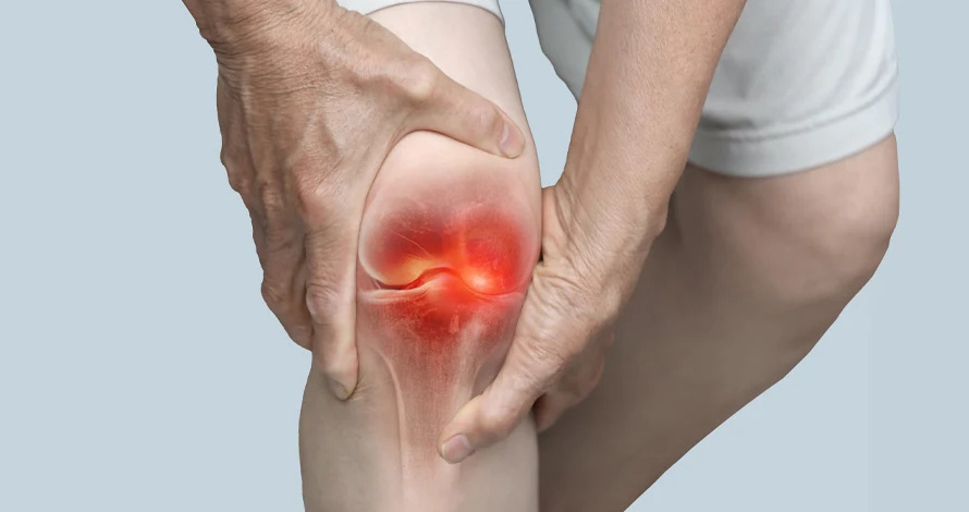 Rheumatoid Arthritis